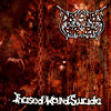 Abysmal Torment- Incised Wound Suicide MCD on Brutal Bands